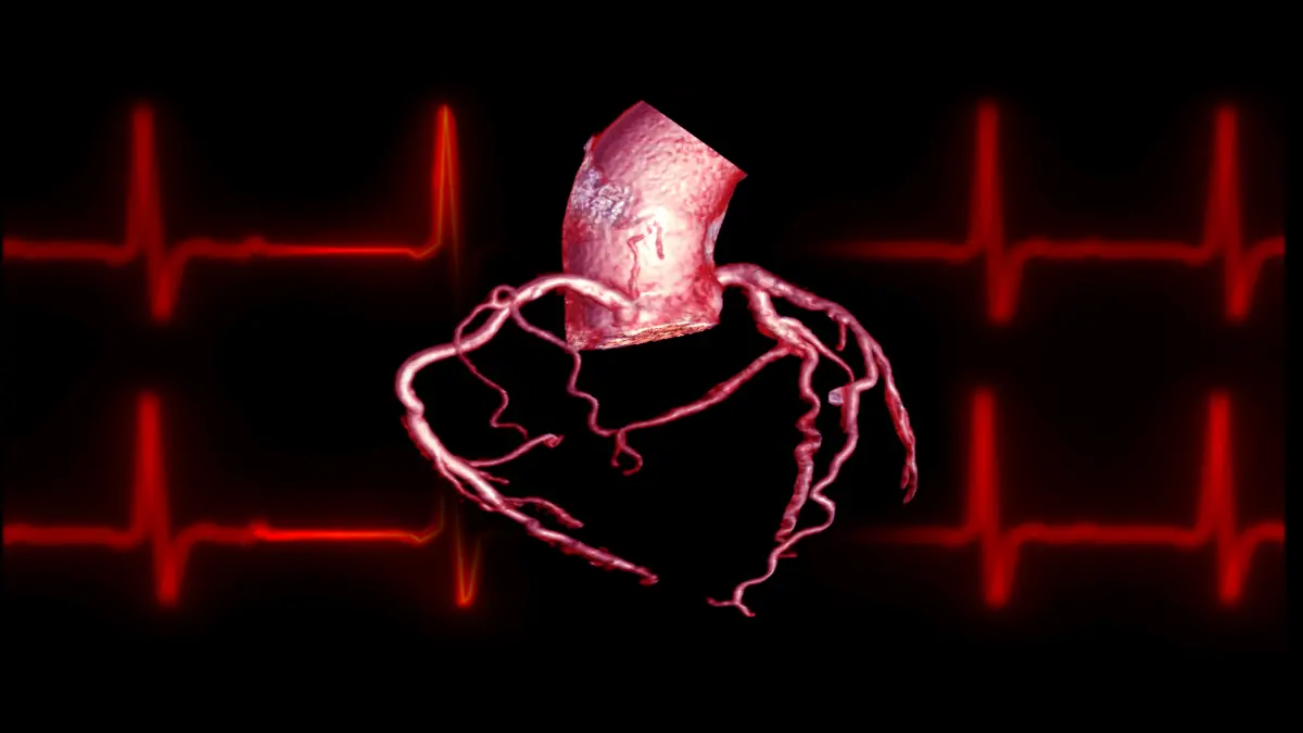 Herzkranzgefäße vor rotem EKG-Hintergrund, medizinische Visualisierung